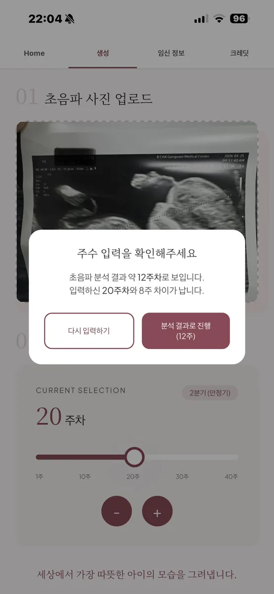 40Weeks - AI 초음파 뷰어 App Store 공개 화면 4