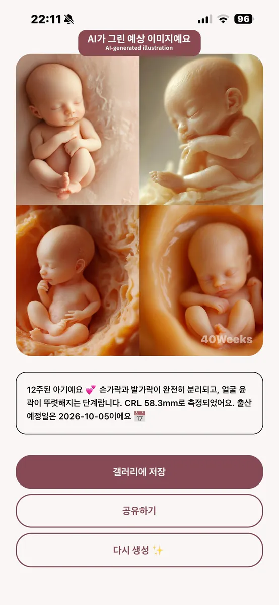 40Weeks - AI 초음파 뷰어 App Store 공개 화면 5